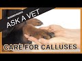 How to Care for Calluses