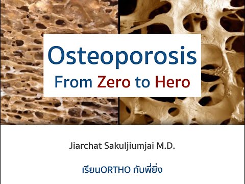 Osteoporosis From Zero to Hero