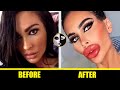 Tara Jayne McConachy -👧 Barbie Doll Plastic Surgery Before and After 👧- ( Lip Injections - Filler )
