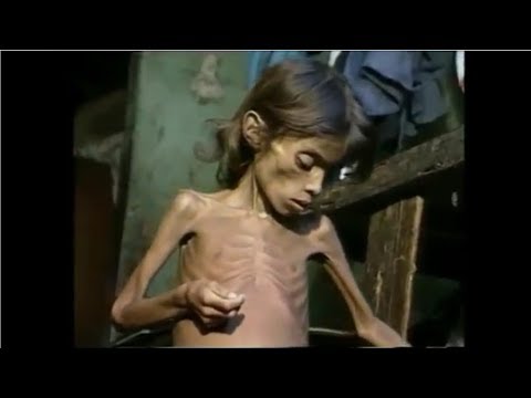 O Brasil que Passava Fome - Jornal Nacional (2001) - Fome Mata 300 Crianças por dia antes do PT