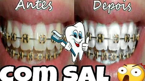 Quais os benefícios de escovar os dentes com sal?