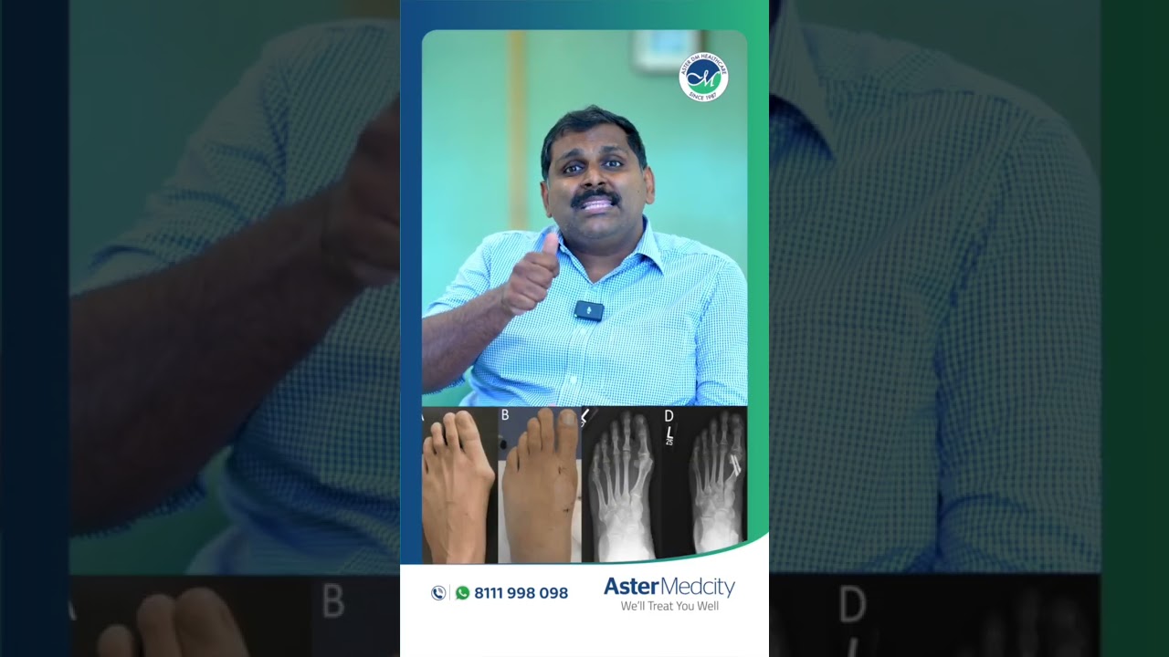 Foot and Ankle Clinic at Aster Medcity