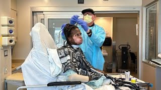 Burn Center Barber - Going Above and Beyond in Patient Care