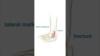 Here's How Ankles Break! Ouch! #shorts #basketball #animation