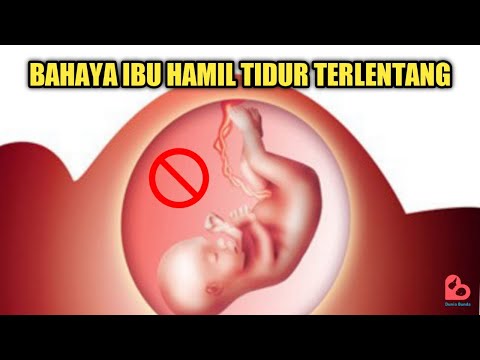 Jangan Lakukan, Inilah Resiko yang Mengintai Jika Ibu Hamil Tidur Terlentang