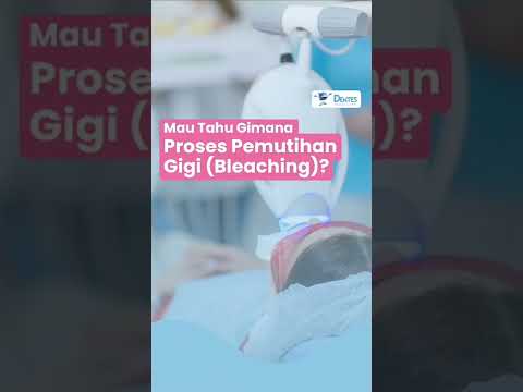 Video: Adakah opalescence pemutihan gigi berfungsi?