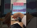 Когда у тебя ВПЧ ,надо ли ставить свечи и пить таблетки?