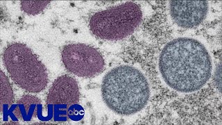 LIVE: Austin-Travis County leaders discuss monkeypox in the area | KVUE