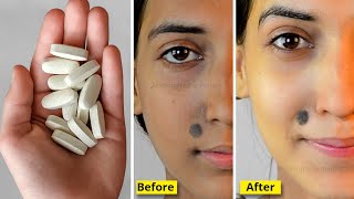 Make Botox Treatment At Home in just 5 MINS *Just 2 Ingredients* INSTANT Face Lift & Glowing Skin screenshot 4