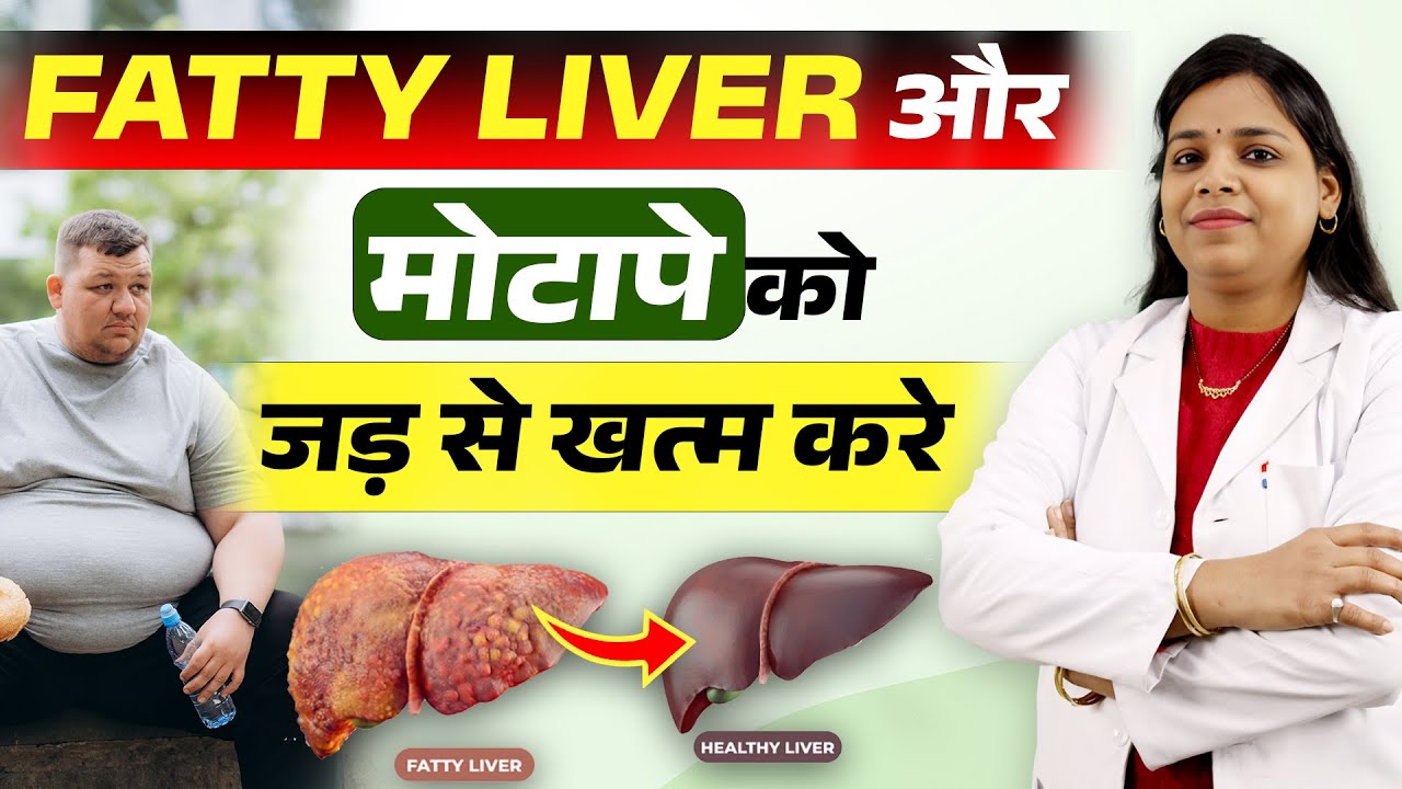 How to reduce fatty liver :Natural Remedy | Bharat Homeopathy