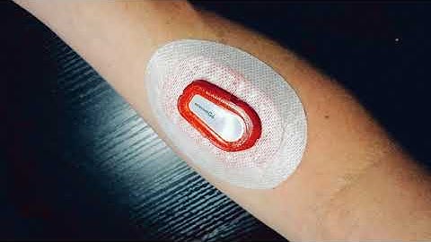 🎖️50/50 Infiniflex by Freedom Band Dexcom G6 Medtronic & Freestyle Libre