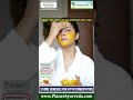 3 Home Remedies for Hyperpigmentation and Ayurveda Pointview