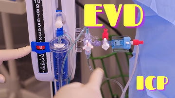 External Ventricular Drainage (EVD) and ICP Monitoring