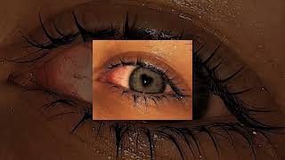 Racismo - Sergio Contreras Carrozzeria