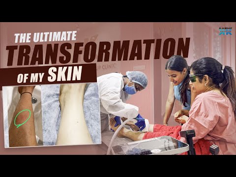 Strawberry Legs nunchi silky Smooth legs??? The ultimate transformation of my legs | Rj kajal