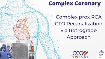 Complex prox RCA CTO Recanalization via Retrograde Approach