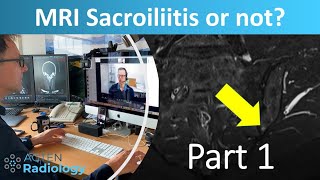 Sacroiliitis or not? - with Prof. Hermann - Part 1