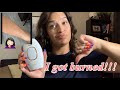 My Kenzzi burned my arms | my scars | Vitamin E oil | I got burned | Kenzzi review | Kenzzi update