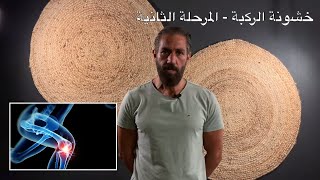 ١٨- علاج خشونة الركبة, تآكل الغضروف, الفصال العظامي, التهاب المفاصل - سوفان الركبة - المرحلة الثانية