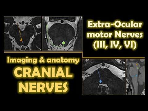 健康・医学 Anatomy and Imaging of the Cranial Nerve hqdefault.jpg