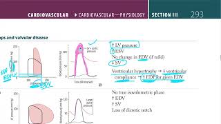USMLE - CVS Cardiology Murmurs Made Simple | USMLE Cardiology | (USMLE Step 1)