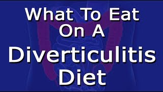 Diverticulitis Diet: What To Eat