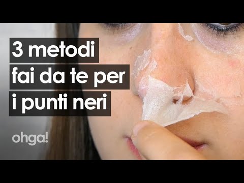 Come togliere i punti neri con 3 rimedi naturali ed efficaci fai da te