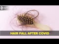 Post Covid Hair Loss | Complementary Cure for Covid hair loss-Dr. Surekha Tiwari | Doctors