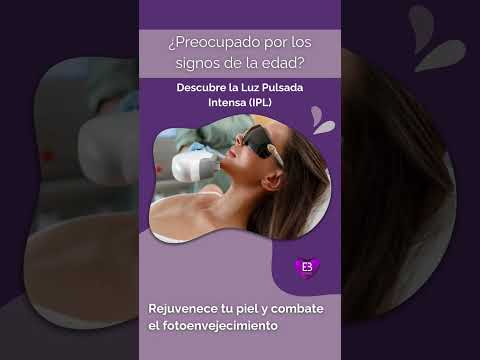 ¡Luce una piel más joven y radiante con IPL!
