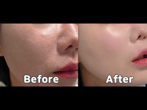 하루 10분 투자했을 뿐인데… 셀테르 더 노바 전/후 차이 뭐죠?