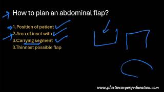 Planning of abdominal flaps and their vascular basis