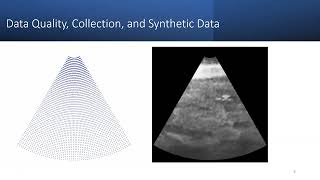 Improving Machine Learning Model Performance with a Data-Centric Approach