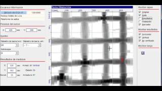 Radiografia De Cabezal De Muro De Hormigon Armado Wwwbdlcl