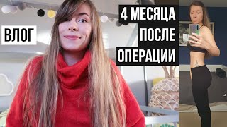 Что же там с моим животом после операции + 🦊