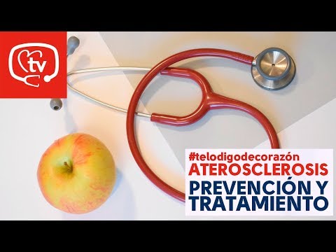 Vídeo: 7 Remedios Caseros Más Efectivos Para La Aterosclerosis