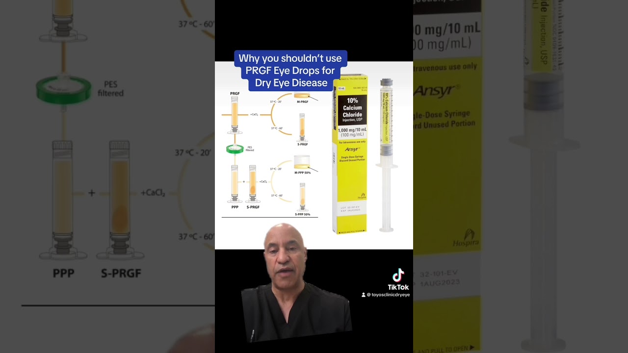 Why you shouldn't use PRGF Eye Drops for Dry Eye Disease - platelet rich growth factor