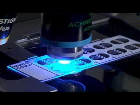 ما هو مسح آنا يوتيوب