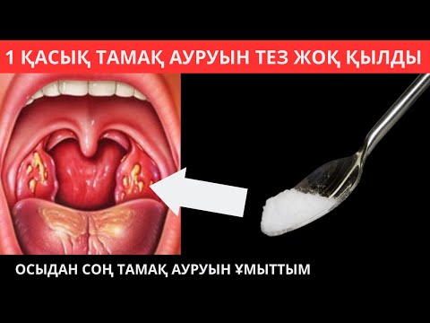 Бейне: Тамақ ауруы қаншалықты жұқпалы?