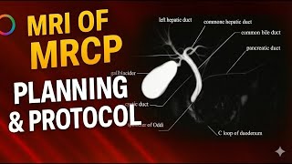 MRI of MRCP Planning & Protocol step by step guide 