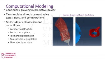 Use of Predicitive Modeling in Trans-catheter Heart Valve Replacement