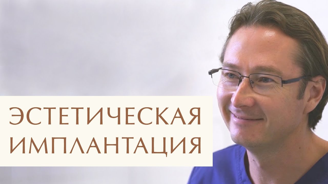 😊 Этапы и виды имплантации передних зубов. Этапы имплантации зубов. 12+