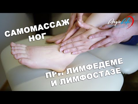 Самомассаж ног при лимфостазе и лимфедеме. Лечение лимфостаза дома. Лечение отеков. Массаж лимфедема