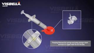 Visbella Windshield Repair Kit Windshield crack repair chip repair