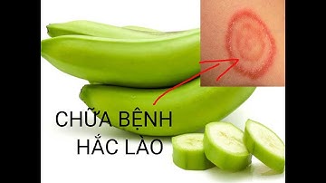 Mẹo chữa hắc lào bằng chuối xanh đúng cách