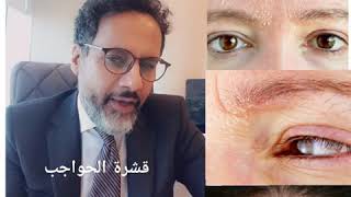 قشرة الحواجب  ، اسباب قشرة الحواجب ، قشور الحواجب Seborrheic dermatitis دكتور علي باجنيد