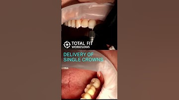Maximize the effectiveness of implant surgery and prosthodontics with TFW! #tfworkflows