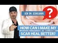 How to Heal Scars | How Can I Make My Scar Heal Better? - Ask Dr Schulman