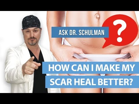 How to Heal Scars | How Can I Make My Scar Heal Better? - Ask Dr Schulman