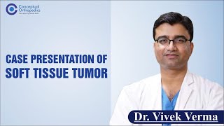 Case Presentation of Soft Tissue Tumor By Dr. Vivek Verma screenshot 5