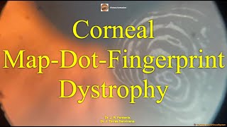 Corneal map-dot-fingerprint dystrophy.